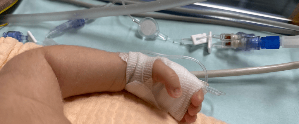 IV in baby’s hand